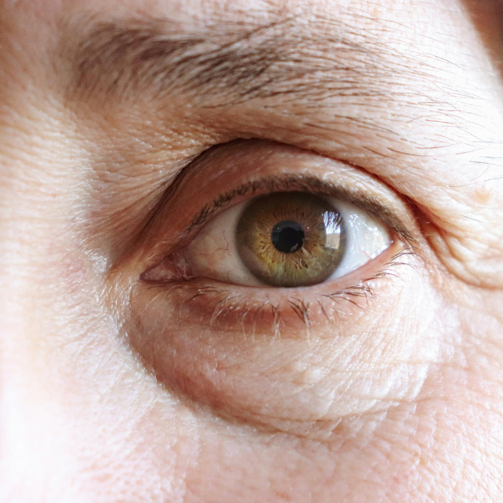 macular degeneration erin mills mississauga